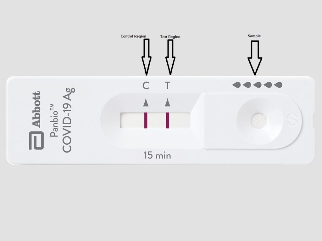 COVID-19 Rapid Antigen Test