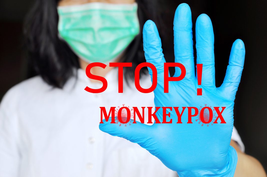 Monkeypox update
