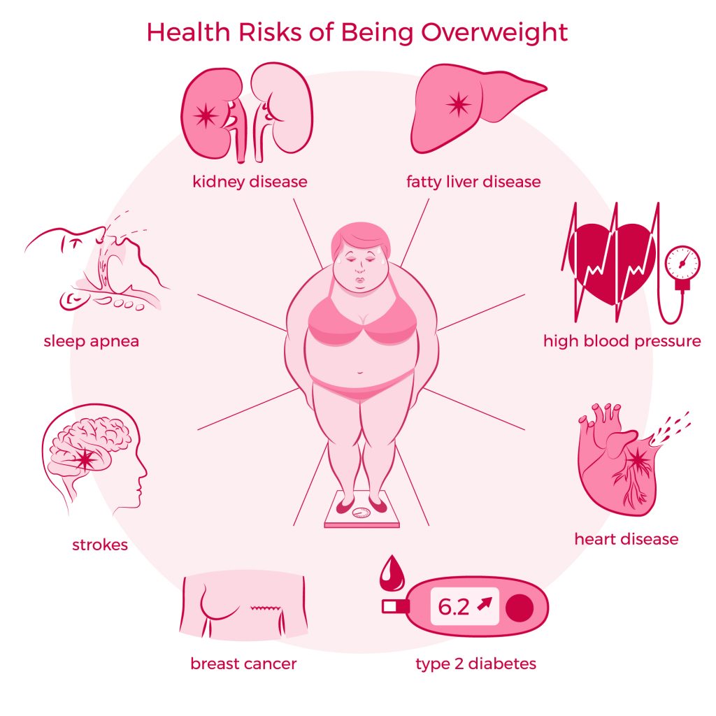 The dangers of an expanding belly - SeniorsToday