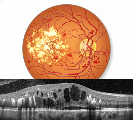 Why Protecting your Central Vision is the Key to Staying Independent Why Protecting your Central Vision is the Key to Staying Independent